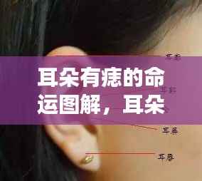 耳朵痣相图解,揭示星相与人生轨迹的神秘联系,命运解读新篇章